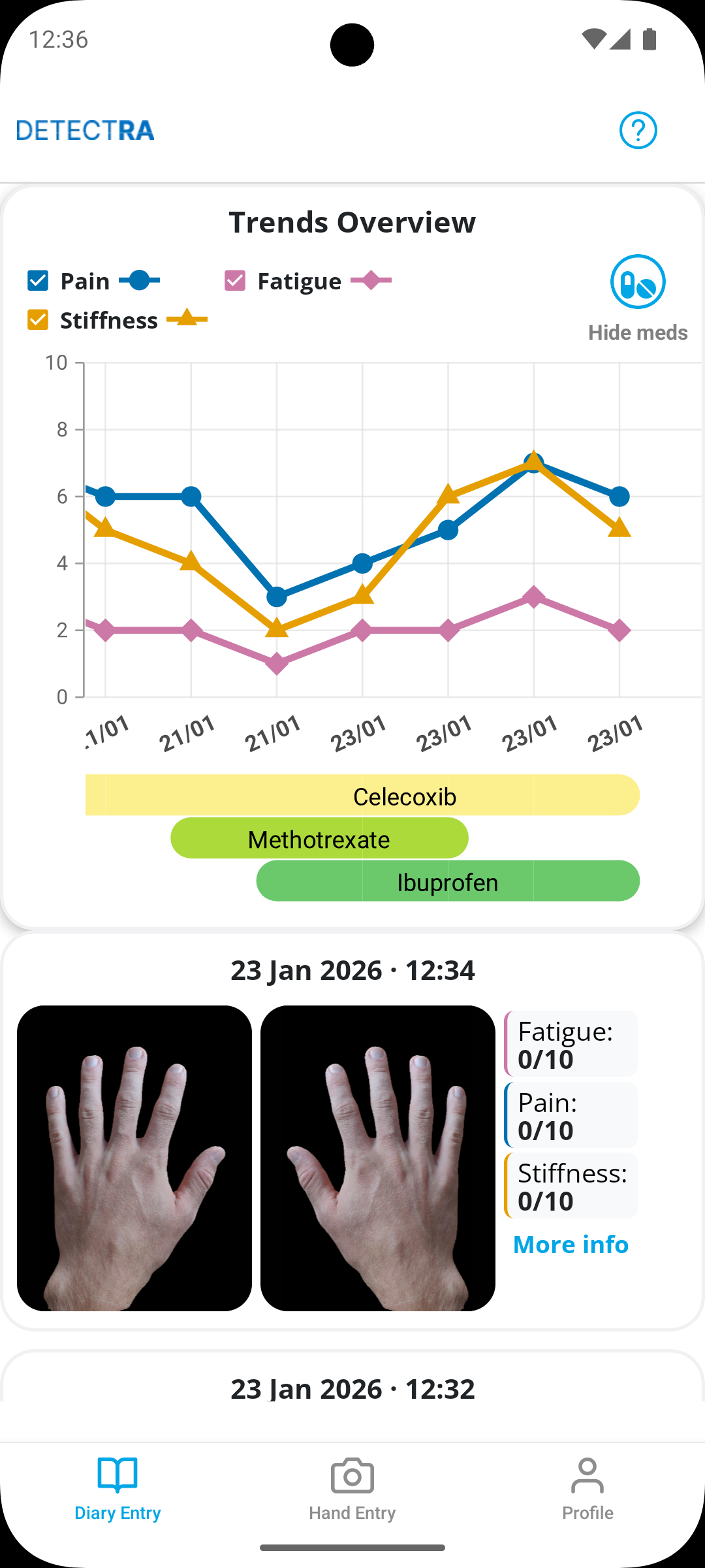 Joyn mobile application displaying symptom trends and recent hand entries