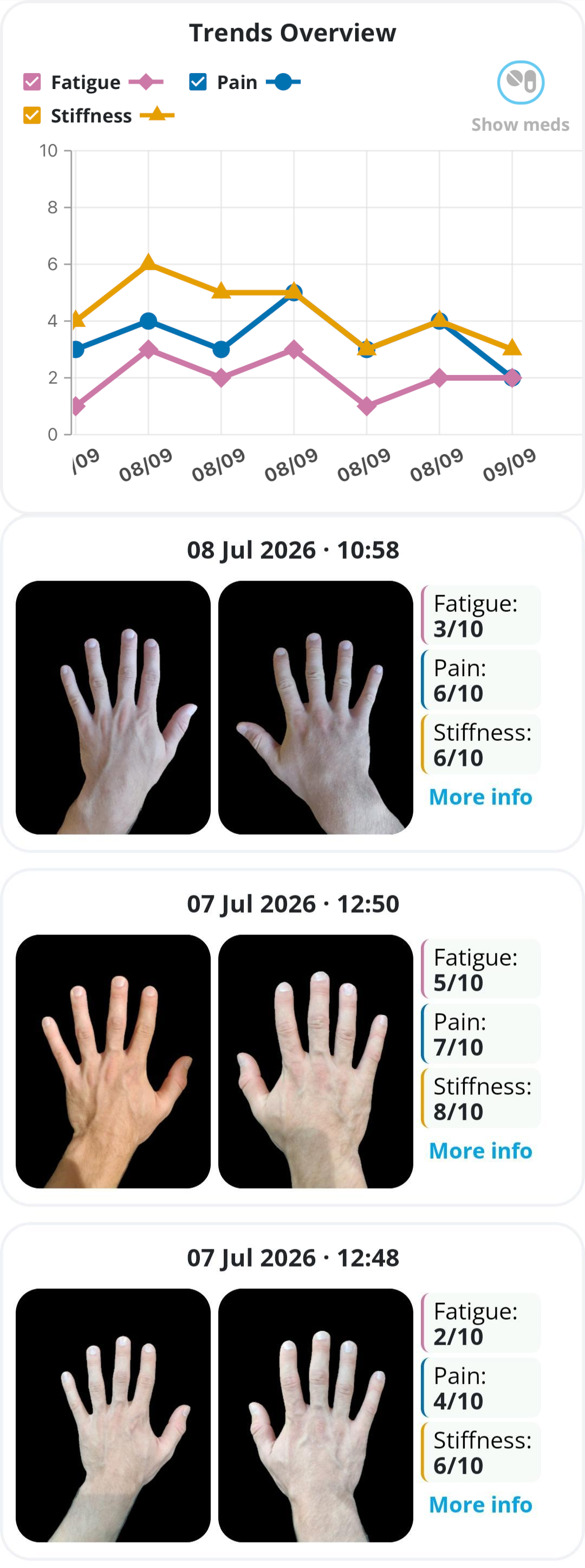 Joyn app entry with hand images, symptom scores and medication