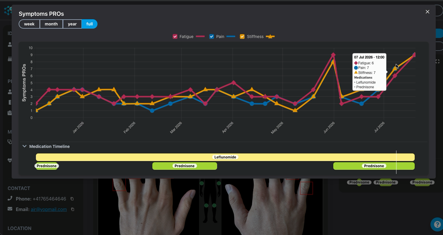 Joyn longitudinal symptom chart over several months with medication timeline
