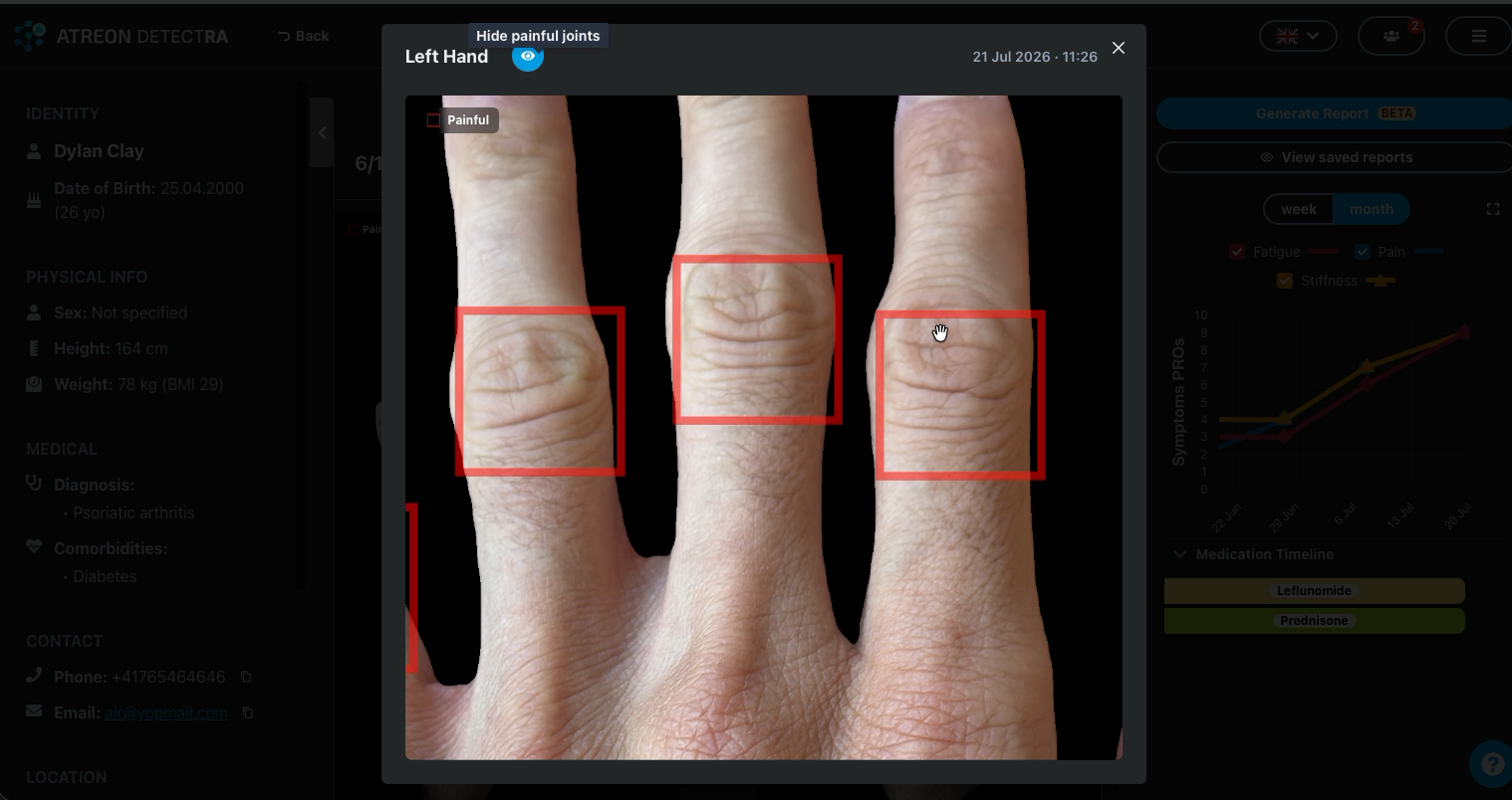 Joyn zoomed hand image with painful joints highlighted