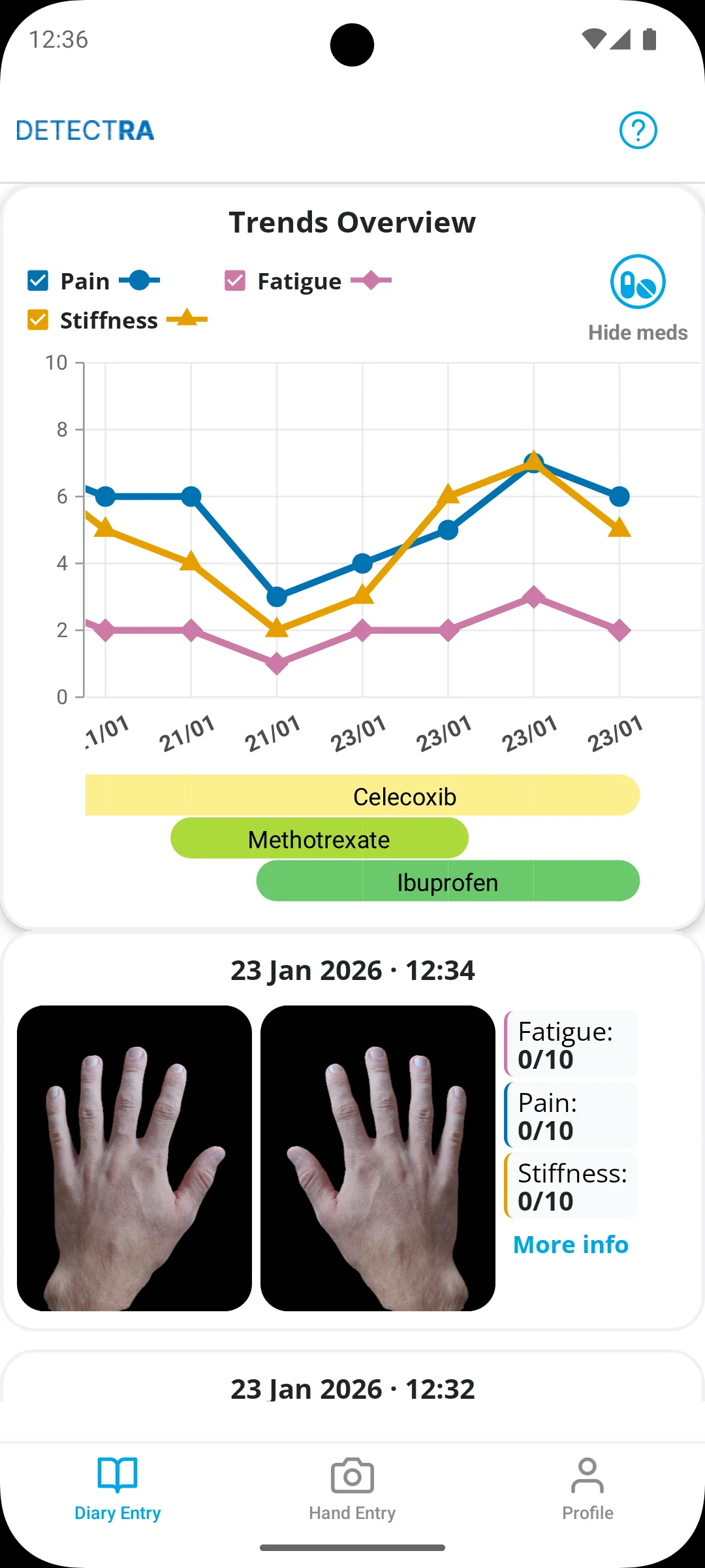 JOYN mobile application displaying symptom trends and recent hand entries